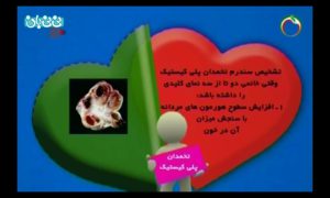 تشخیص و درمان تنبلی تخمدان